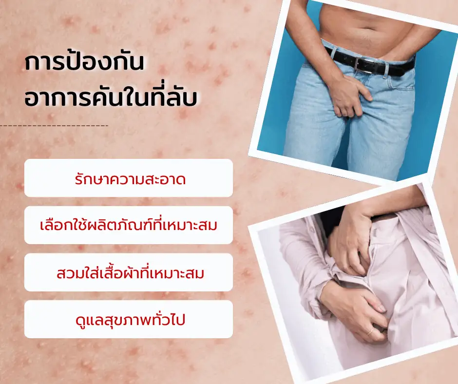 การป้องกันอาการคันในที่ลับ