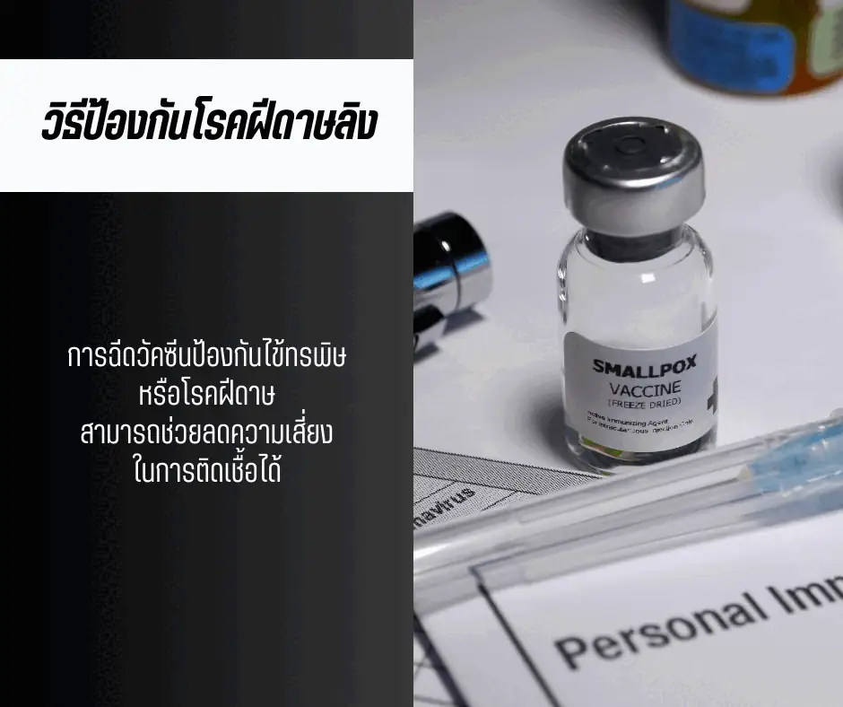 วิธีป้องกันโรคฝีดาษลิง