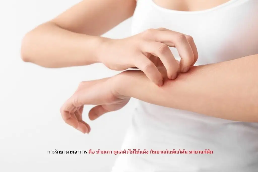 รักษาตามอาการ