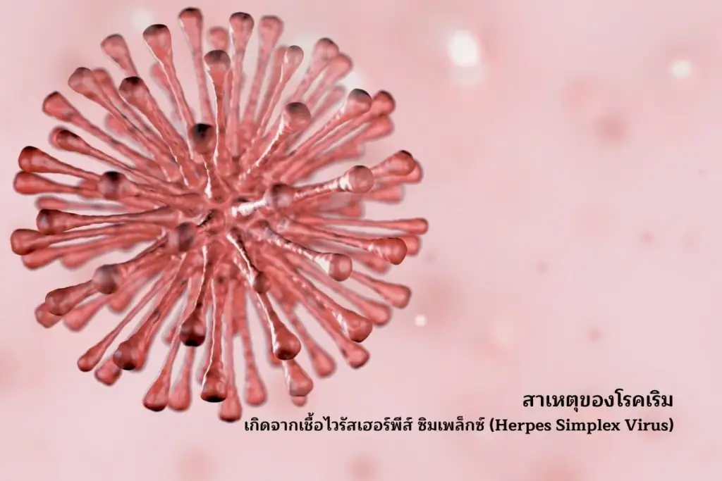 Herpes Simplex Virus