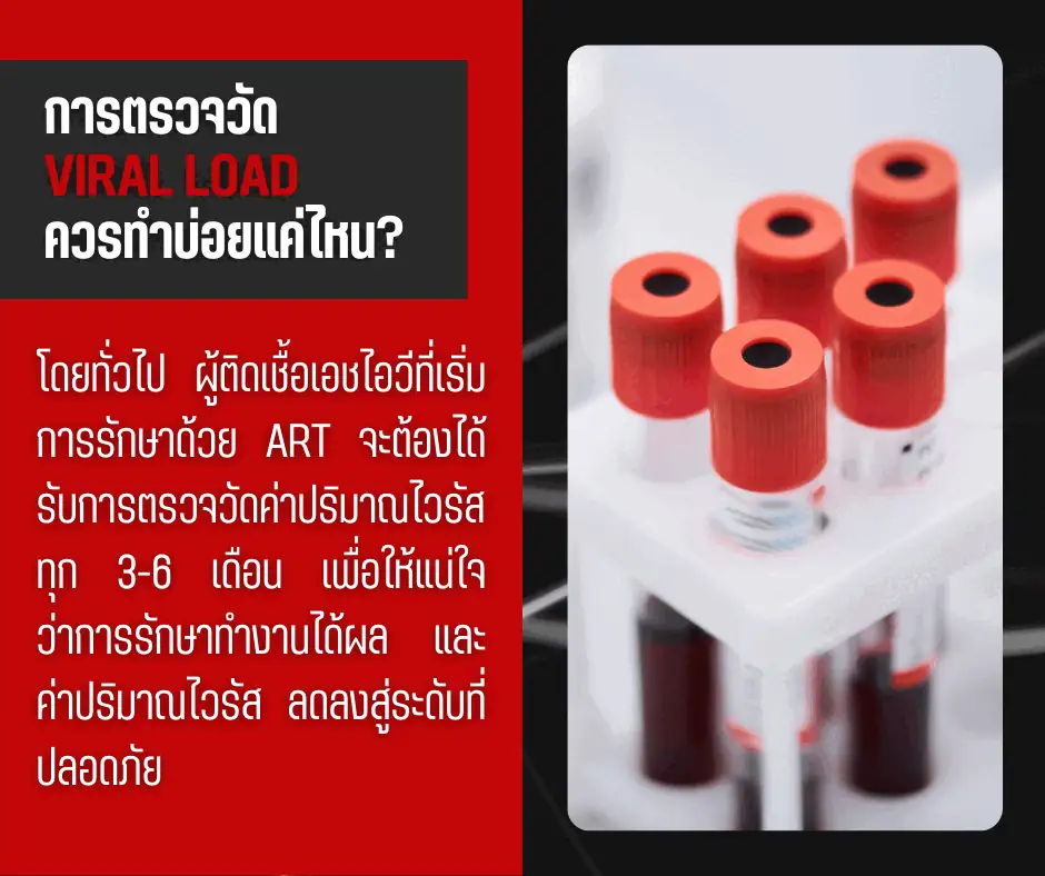 การตรวจวัด Viral Load ควรทำบ่อยแค่ไหน