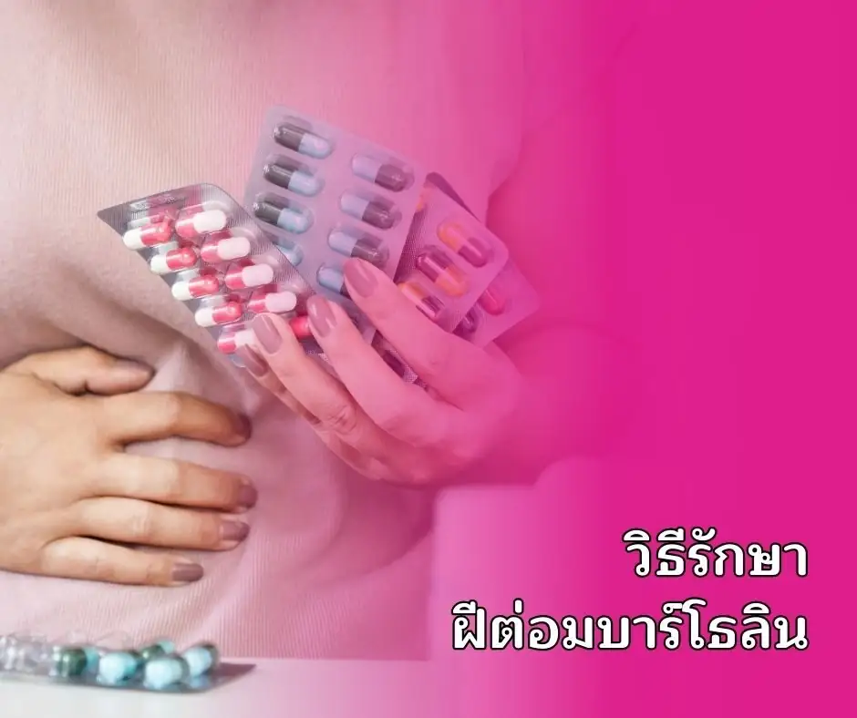 วิธีรักษาฝีต่อมบาร์โธลิน