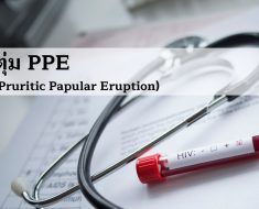ตุ่ม PPE (Pruritic Papular Eruption)