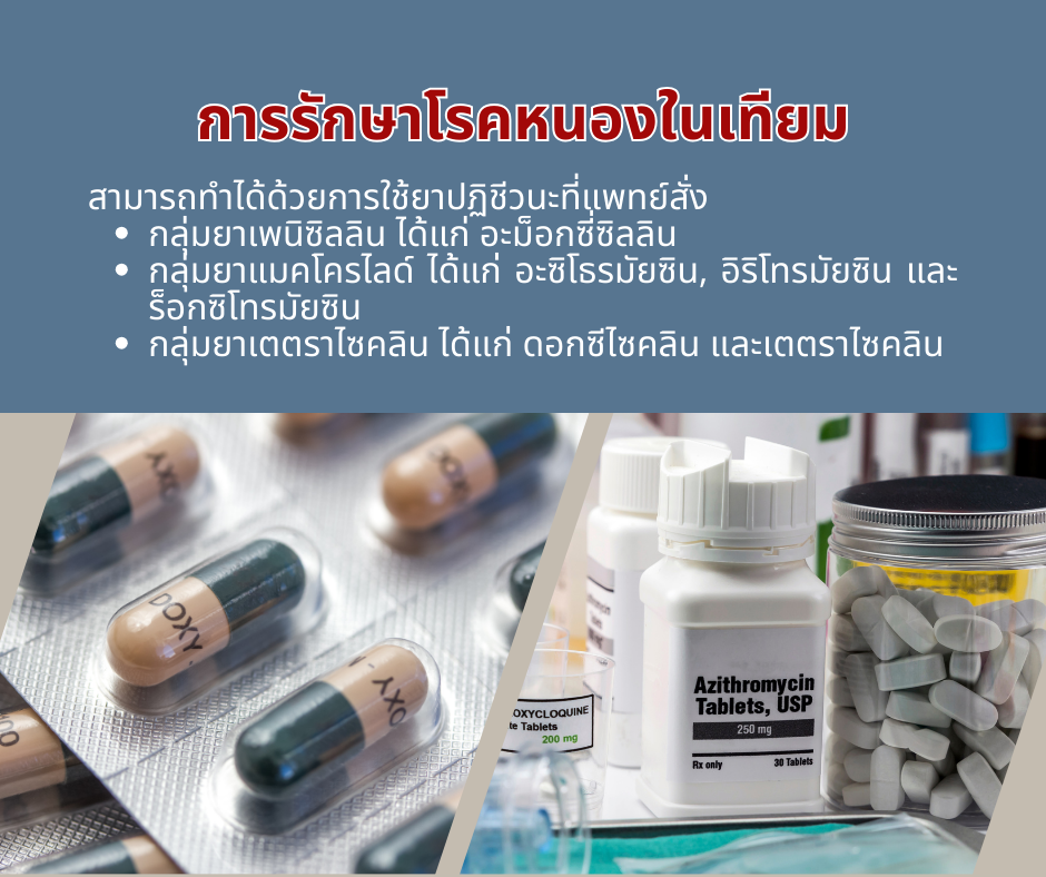 การรักษาโรคหนองในเทียม