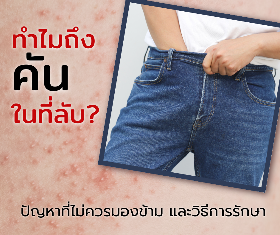 ทำไมถึงคันในที่ลับ? ปัญหาที่ไม่ควรมองข้ามและวิธีการรักษา