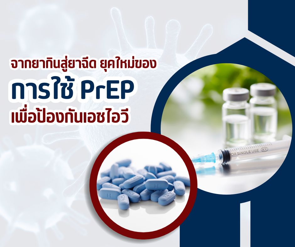 จากยากินสู่ยาฉีด ยุคใหม่ ของการใช้ PrEP เพื่อป้องกันเอชไอวี