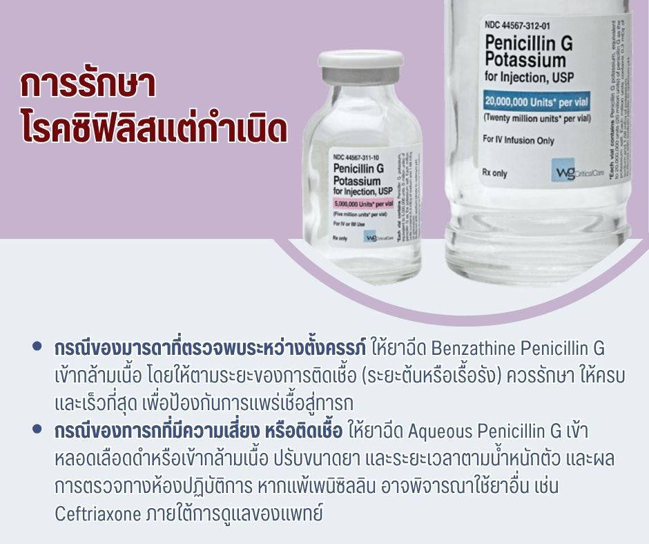 การรักษาโรคซิฟิลิสแต่กำเนิด