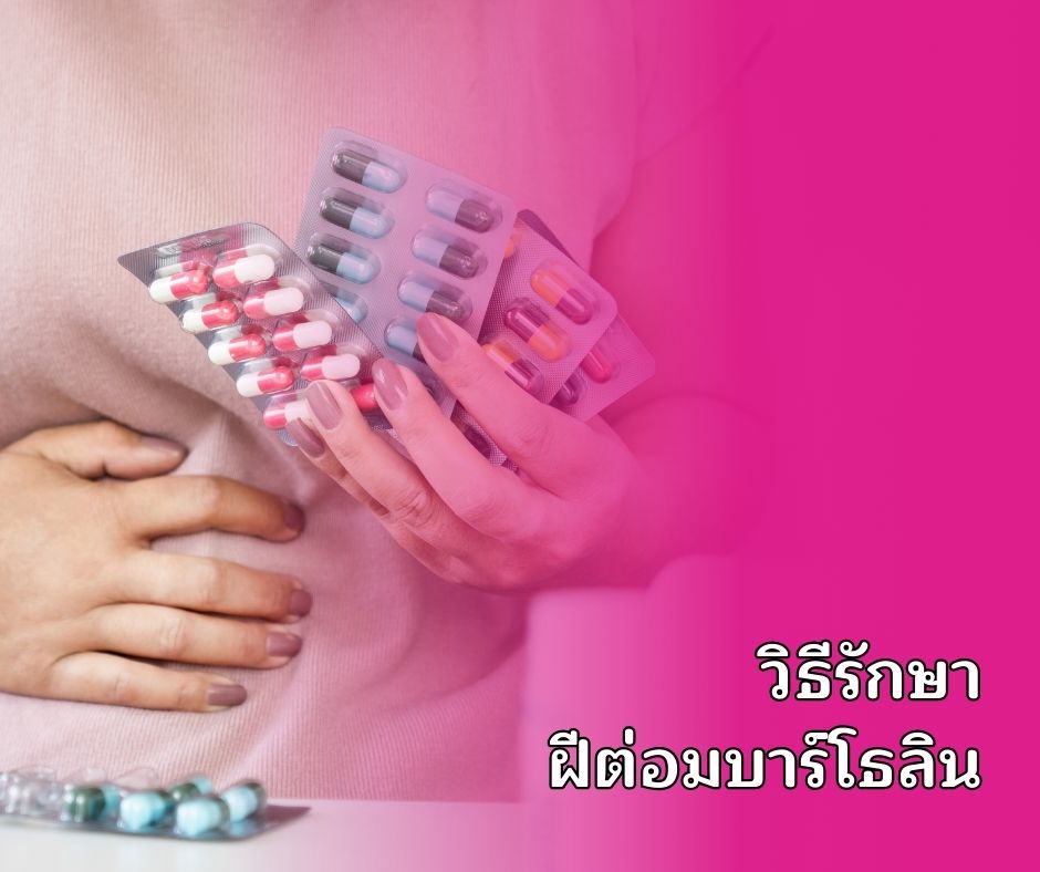 วิธีรักษาฝีต่อมบาร์โธลิน