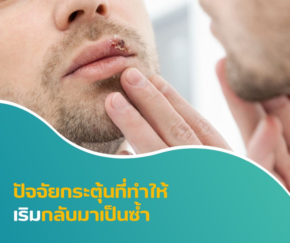 ปัจจัยกระตุ้นที่ทำให้เริมกลับมาเป็นซ้ำ