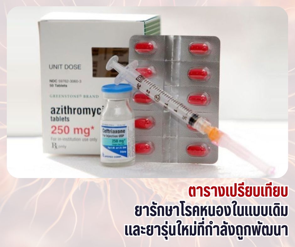 ตารางเปรียบเทียบยารักษาโรคหนองในแบบเดิม และยารุ่นใหม่ที่กำลังถูกพัฒนา