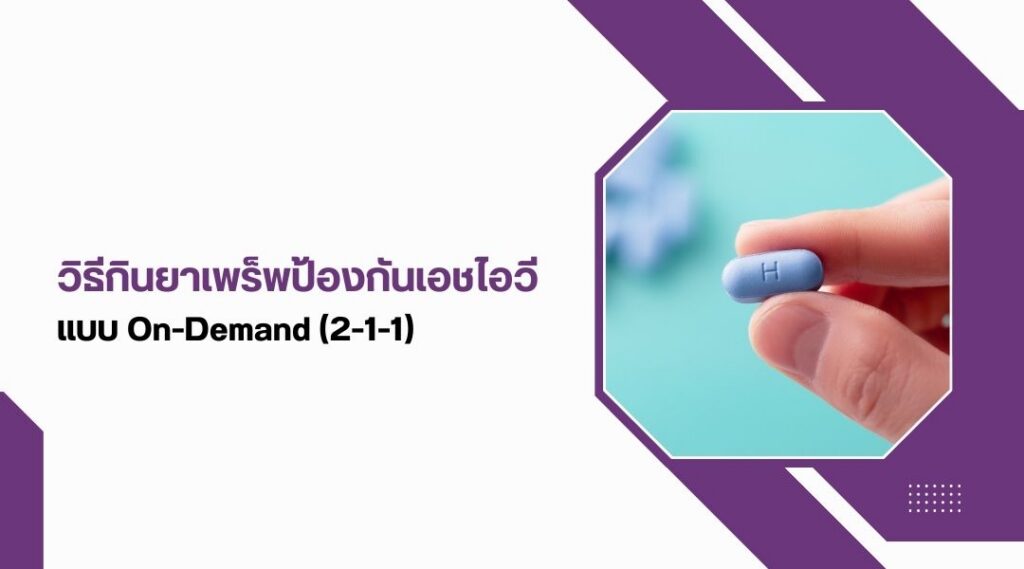 วิธีกิน ยาเพร็พป้องกันเอชไอวี แบบ On-Demand (2-1-1)