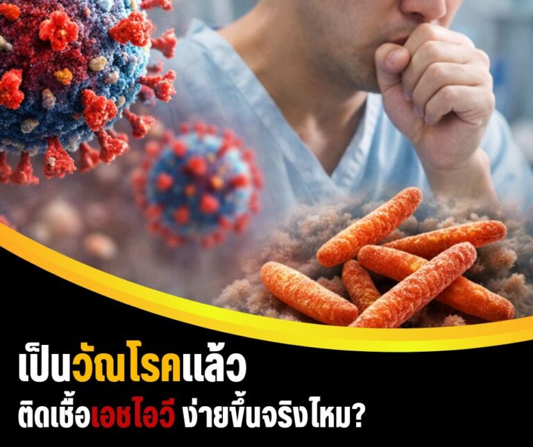 เป็นวัณโรคแล้วติดเชื้อเอชไอวีง่ายขึ้นจริงไหม?