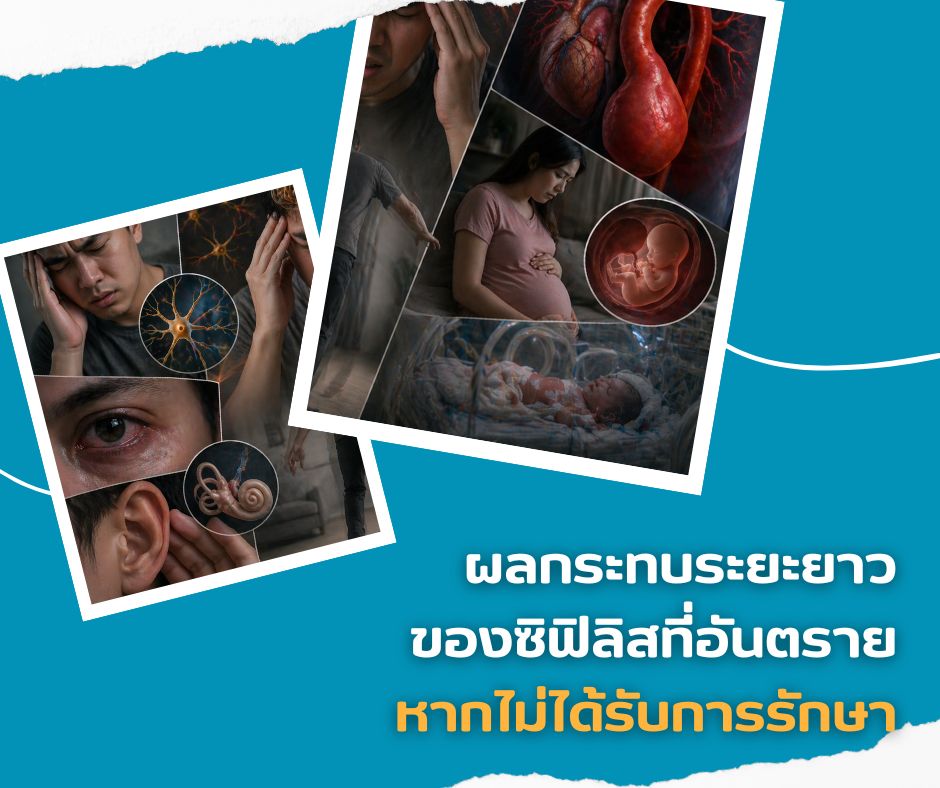 ผลกระทบระยะยาว ของซิฟิลิสที่อันตราย หากไม่ได้รับการรักษา